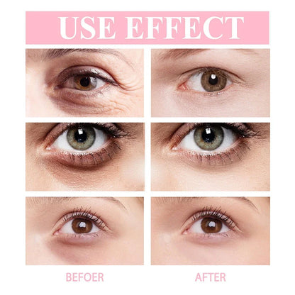 Retinol Anti-wrinkle Eye Cream Anti Puffiness Remove Dark Circles Eye Bags Stick Fade Fine Line Whitening Moisturizing Skin Care