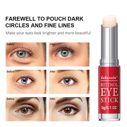 Anti-Wrinkle Eye Cream Retinol Remove Eye Bags Dark Circles Anti Aging Lifting Whitening Moisturizing Brighten Eye Primer