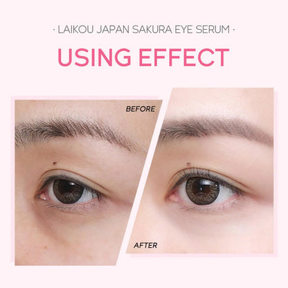 15ml Sakura Serum Eye Massage Cream Slide Ball Firming Essence Remover Dark Circles Eye Bag Anti-Puffiness Eye Skin Care